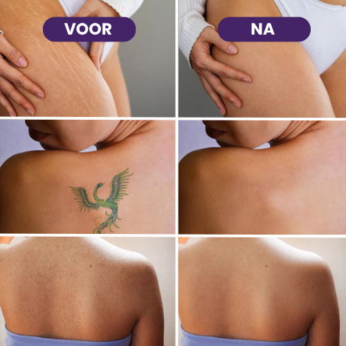 Body Coverage Perfector